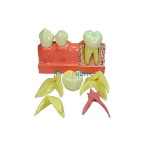4 times Disassembling Teeth Model