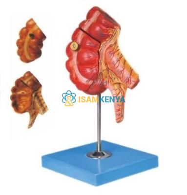 Caecum and Appendix Model