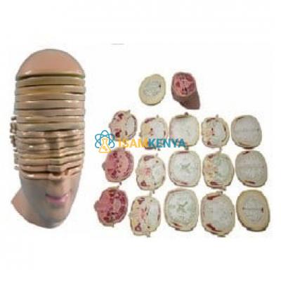 Head and Neck Model Horizontal Shears