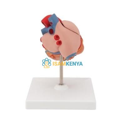 Heart Hypertrophy Model