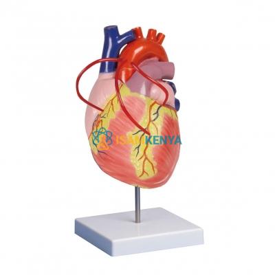 Heart with Bypass Model