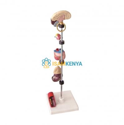 Hypertension Model 6-Parts