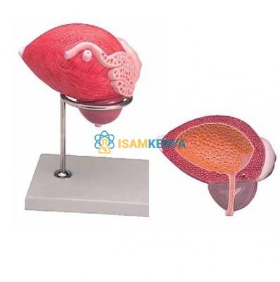Male Urinary Bladder with Prostate Model