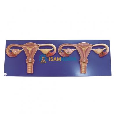 Natural Uterus