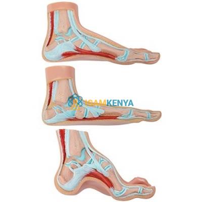 Normal and Abnormal Feet Model
