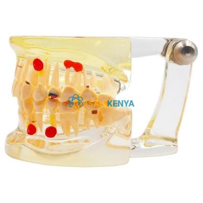 Oral Clinic Transparent Adult Teeth Model