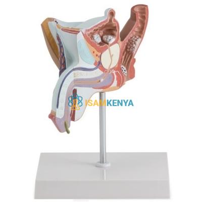 Pathological Model of The Male Urogenital System