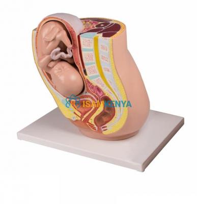 Pregnancy pelvis with Mature Fetus 2 parts