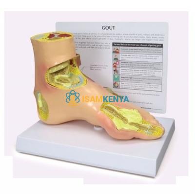Section of Foot Model