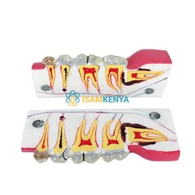 Teeth Model