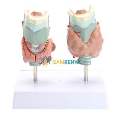 Thyroid Diseases Model 4 Parts